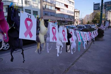 KBC rijeka