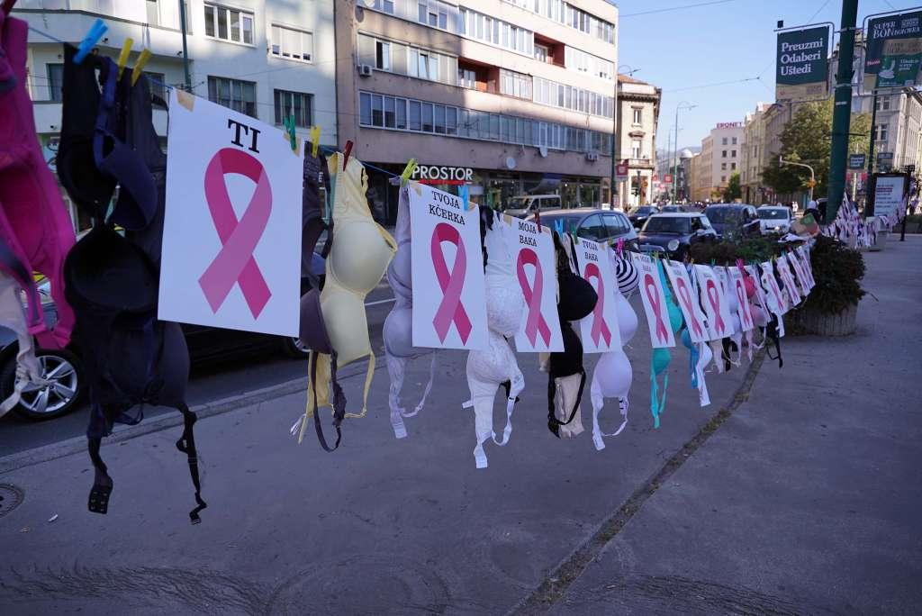 KBC rijeka